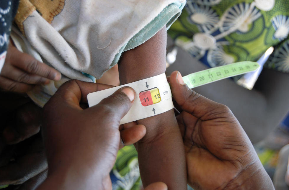 Am Arm eines Kindes wird mit einem MUAC-Massband sein Ernährungszustand gemessen. Er liegt knapp im roten Bereich. 